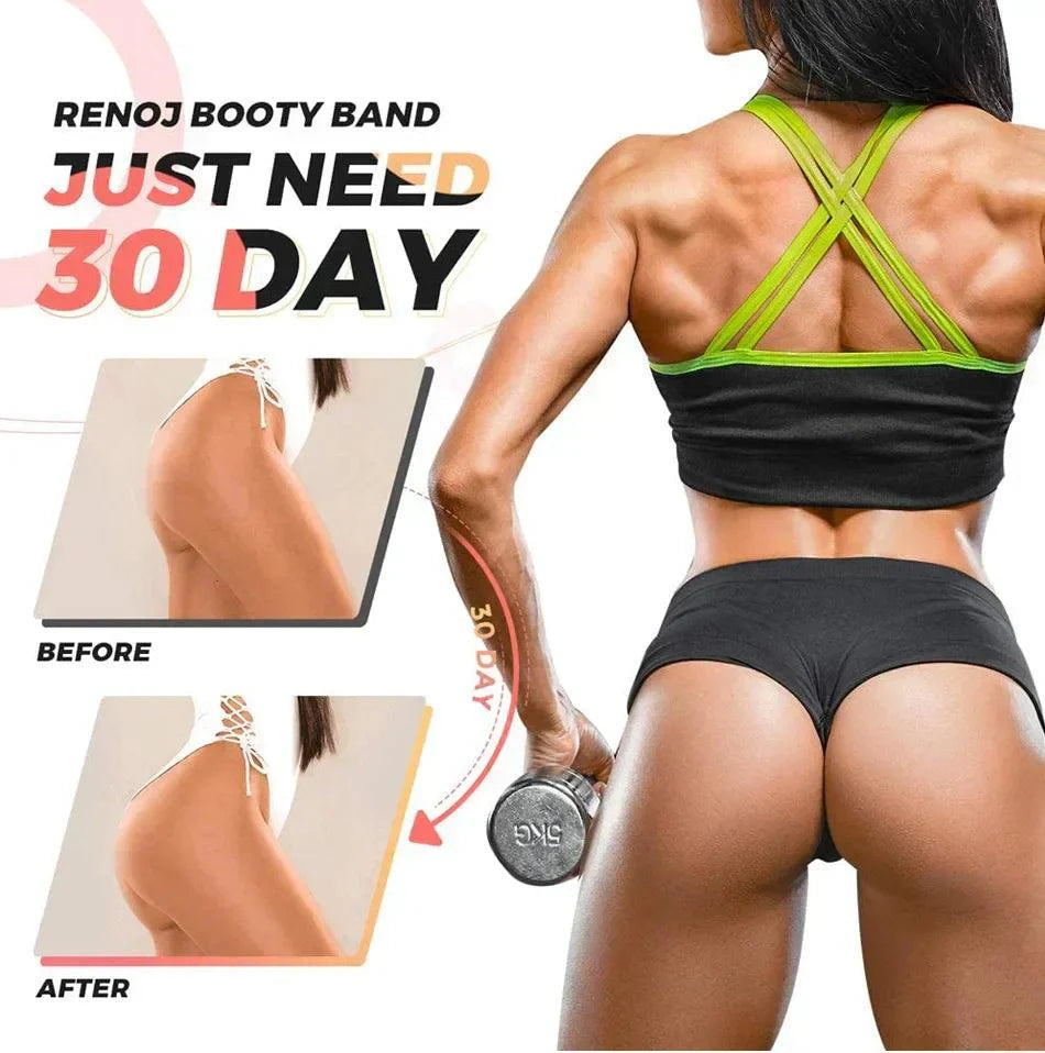 WOSWEIR Elastic Rubber Bands Set
