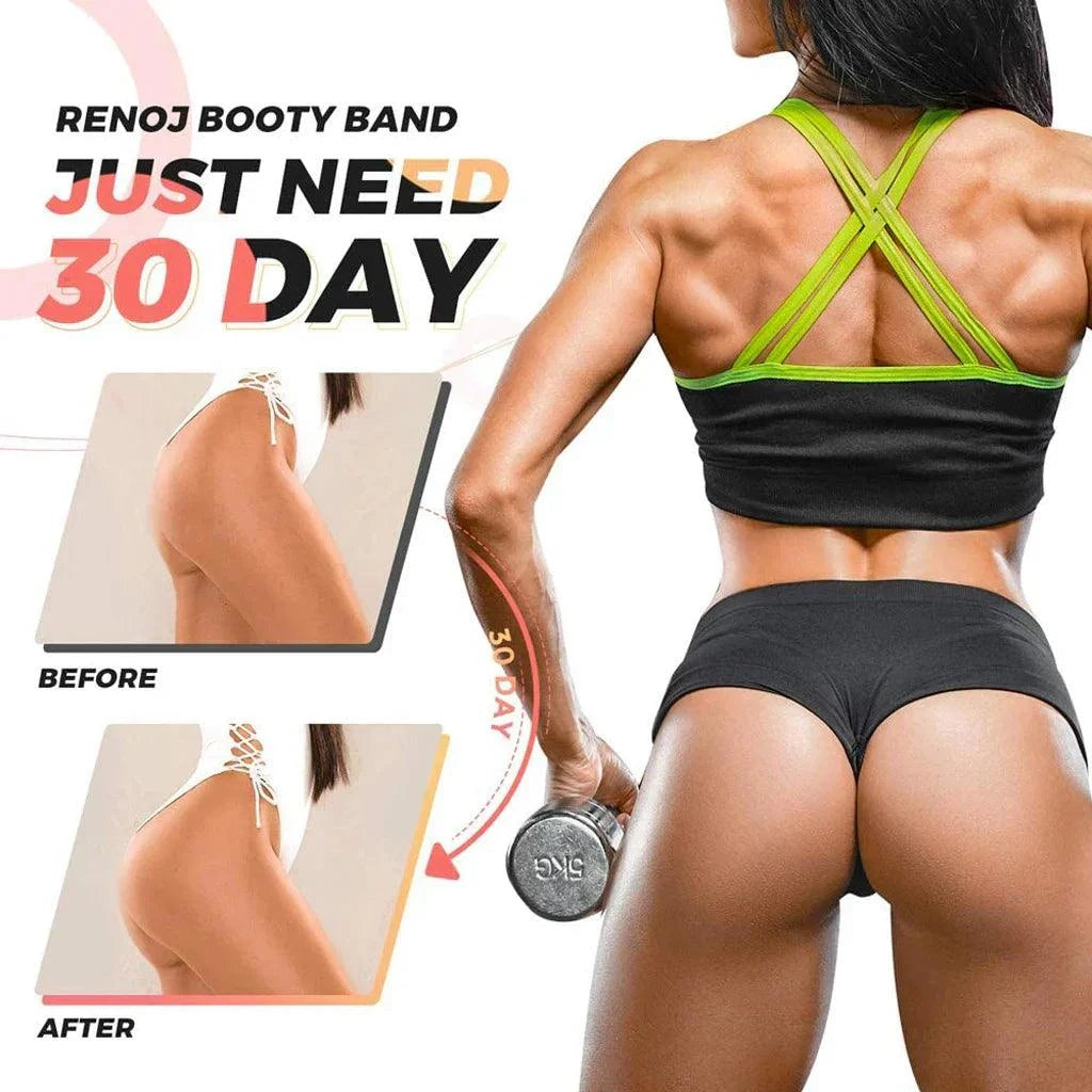 WOSWEIR Elastic Rubber Bands Set